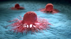 موفقیت دانشمندان ایرانی در همکاری با پژوهشگران ۳ کشور جهان/ ساخت نانوژلی که سرطان پستان را نشانه می‌گیرد