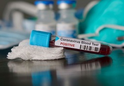 تزریق ۳۰ هزار دوز واکسن کرونا در شبانه روز گذشته