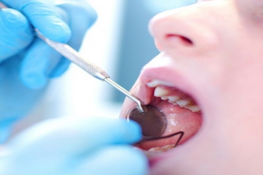 عوارض درمان های نامناسب زیبایی دندان ها/ مراقب لبخندمان باشیم