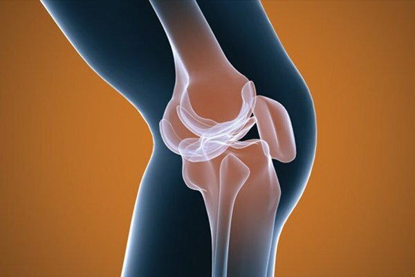 دلایل تاثیر گذار در بروز آرتروز