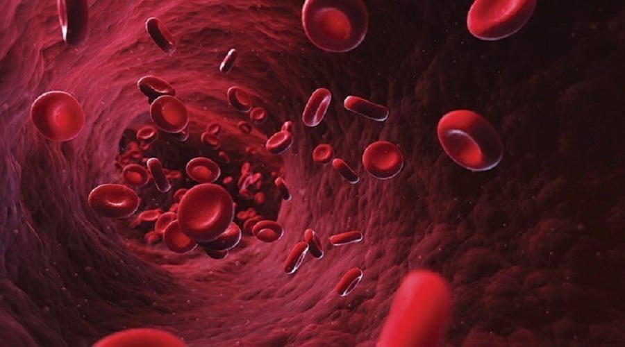 نشانه های کم خونی در زنان/ کمبود آهن بدن چگونه درمان می شود