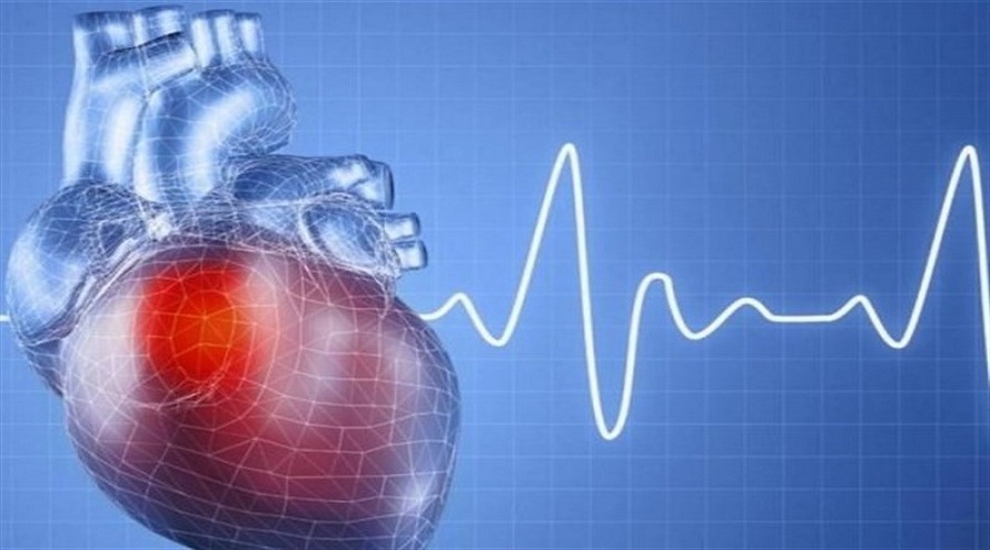 بیماری های قلبی عروقی مهم ترین عامل مرگ و میر