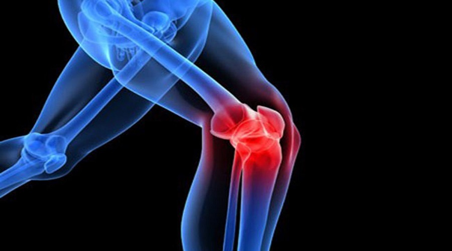 دلایل ایجاد آرتروز و راههای درمان آن
