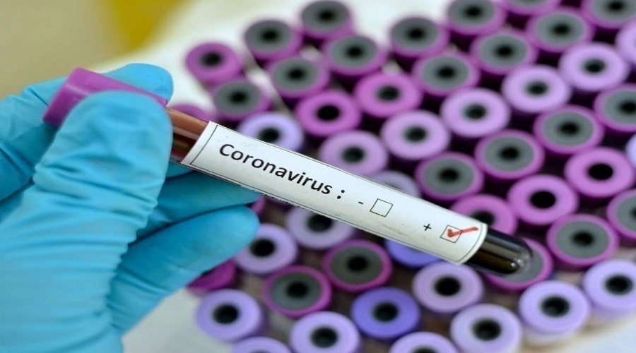 شناسایی ۲۳ بیمار جدید کرونایی در کشور/ ۱۰ نفر بستری شدند