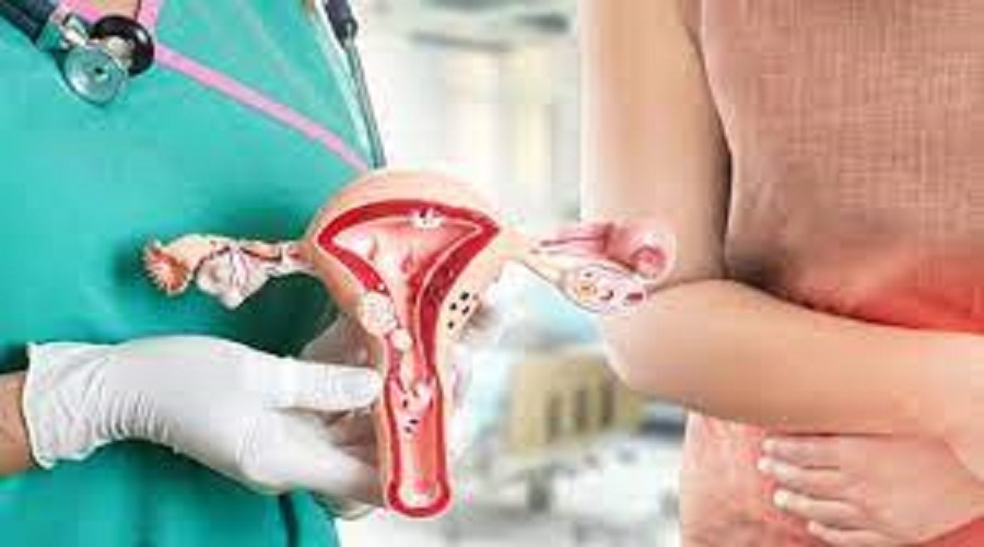 همه چیز درمورد عمل جراحی برداشتن رحم