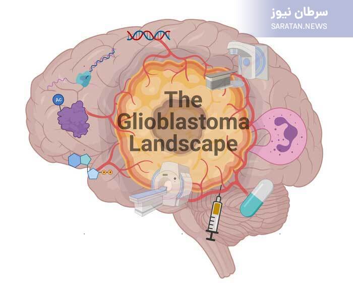 تومور مغزی گلیوبلاستوما چیست؟ تومور مغزی گلیوبلاستوما چیست؟