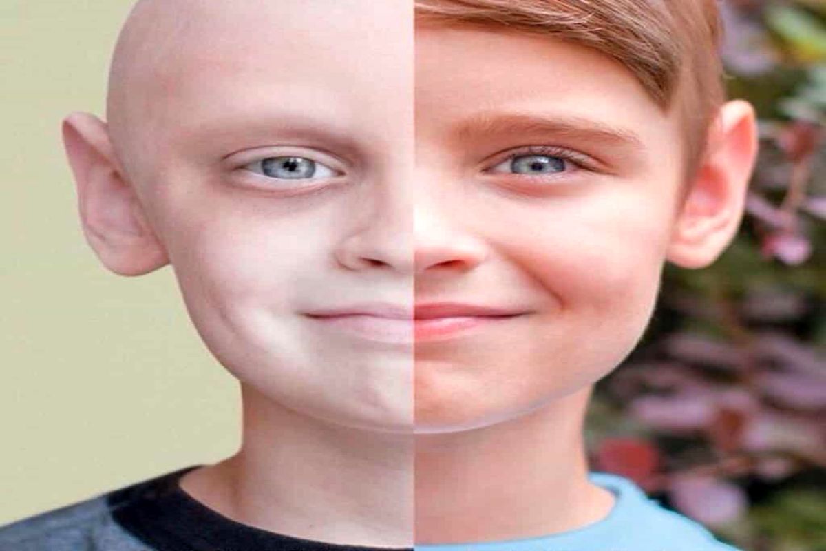 سرطان در کمین کودکان
