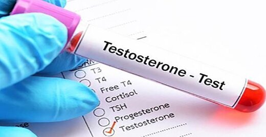 عواملی که با افزایش سن، تستوسترون مردان را کاهش می دهد