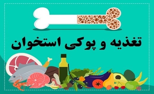 از بیماری خاموش پوکی استخوان چه میدانید؟ از بیماری خاموش پوکی استخوان چه میدانید؟