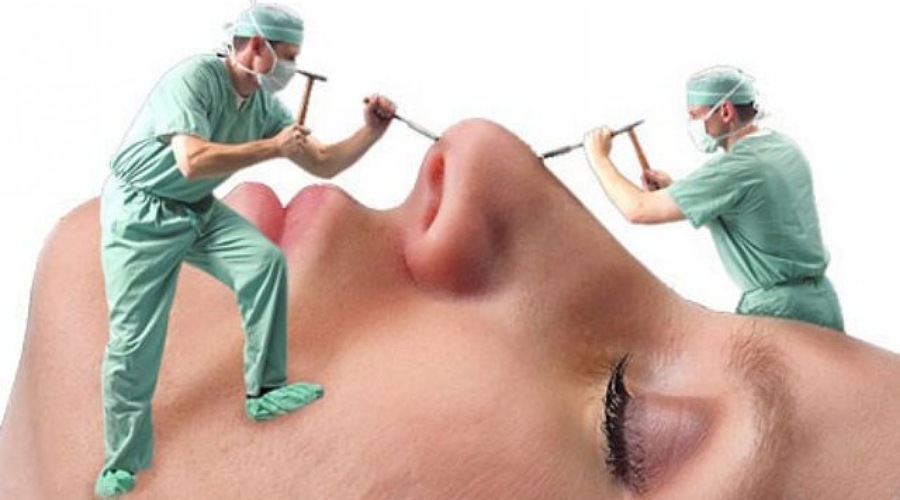 هشدار درباره موج «عملهای زیبایی» در کشور / دلالی جراحیهای زیبایی در فضای مجازی