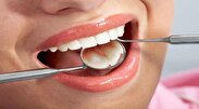 چالش‌های سلامت دهان و دندان در ایران