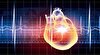فیبریلاسیون دهلیزی عامل زمینه ساز قوی برای نارسایی قلبی است