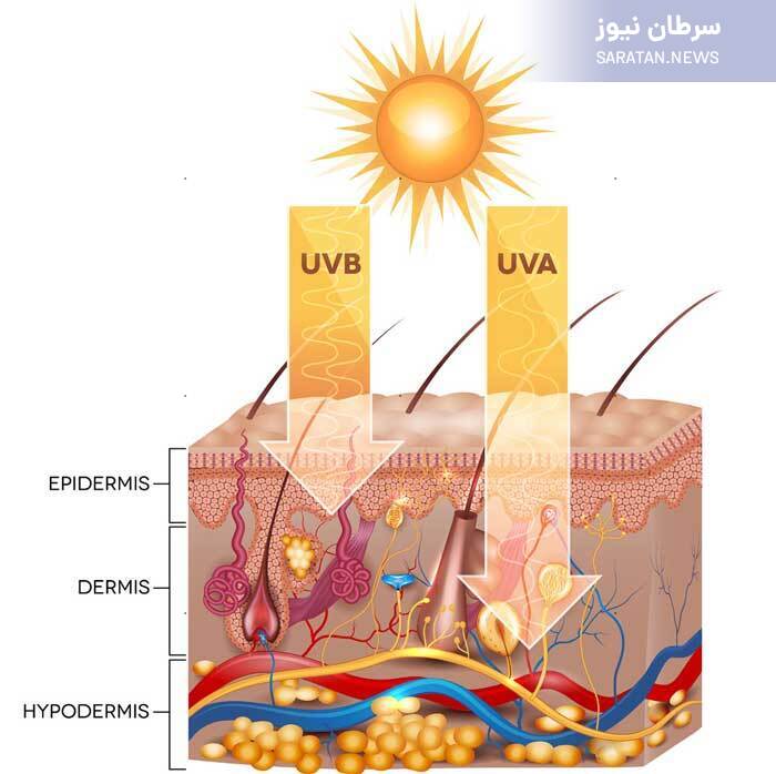 اشعه فرابنفش و پوست انسان/ وقتی خورشید باعث سرطان میشود آفتاب چگونه منجر به سرطان میشود؟