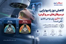 ماسک باز، نفس راحت؛ آیا وقت کنار گذاشتن ماسک‌های بسته در رادیوتراپی سر و گردن رسیده است؟
