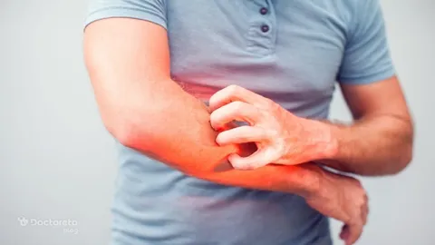 آیا آبله‌مرغان در بزرگسالان خطرناک‌تر است؟