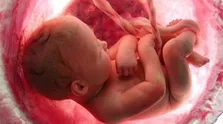 ریسک عوارض بارداری در دختران نوجوان بسیار بالاست