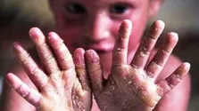 اعضای جدید هیئت‌مدیره خیریه «بال پروانه نصف جهان» انتخاب شدند