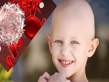 تغذیه بیماران سرطان خون چگونه باید باشد؟