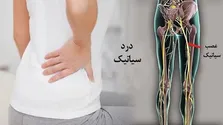 روش نوین محققان ایرانی برای ترمیم ضایعات نخاعی