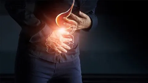 زخم معده پس از درمان کامل نیاز به مصرف طولانی‌مدت دارو ندارد