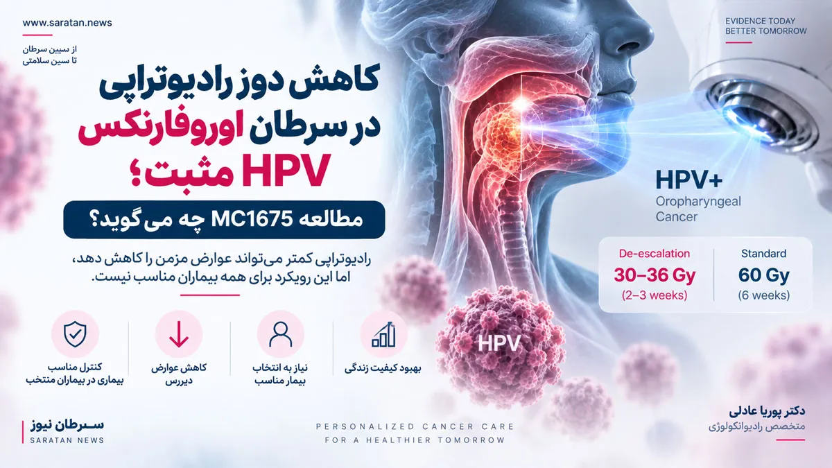 کاهش دوز رادیوتراپی در سرطان اوروفارنکس HPV مثبت؛ مطالعه MC1675 چه می‌گوید؟