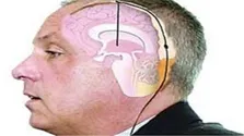 با این تغییر چشم‌ها، نگران پارکینسون شوید