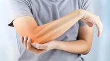 سن بروز آرتروز به جوانی رسید
