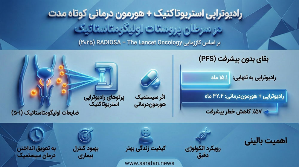 درمان جدید متاستاز پروستات با SBRT و هورموندرمانی درمان جدید متاستاز پروستات با SBRT و هورموندرمانی