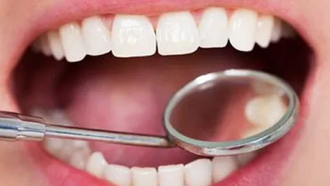دندان‌های مبتلایان به رفلاکس معده در معرض خطر